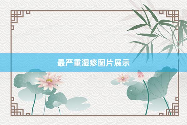 最严重湿疹图片展示